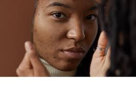 Being seen and accepted after brain injury