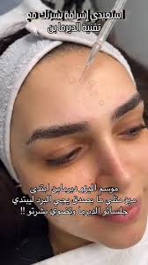 Instagram 用户 Adam laser clinic