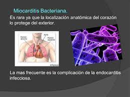Por lo general es debida a una infección viral o bacteriana, y se presenta como dolor de pecho, signos repentinos de insuficiencia cardíaca y muerte súbita. Miocarditis Ppt Descargar