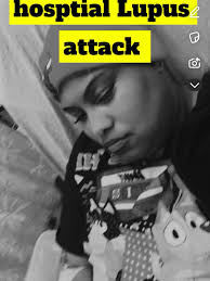 Lupus autoimmune attack symptoms described