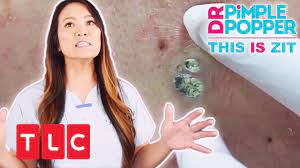 This is zit online, article, story, explanation, suggestion, youtube. This Is Zit Ein Riesiger Mitesser Dr Pimple Popper Tlc Deutschland Youtube
