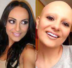 It takes a thick skin to show your head skin. Mistress Cynthia Love Bald Women Extremely Beautiful Bald Without Bald Hairstyles For Women Hair Transformation Hair And Beauty Salon