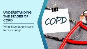 Image result for COPD Staging