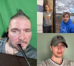 #duet with @derekcasperwalker I can't put my hand up but I can my stick up.  #stopbullyng #fyp