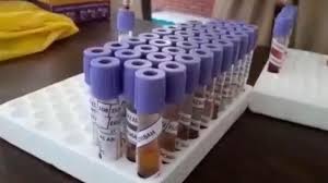 Ribuan Ppdp Di Sidoarjo Rapid Test Ratusan Dinyatakan Reaktif Covid 19 Bagian 1