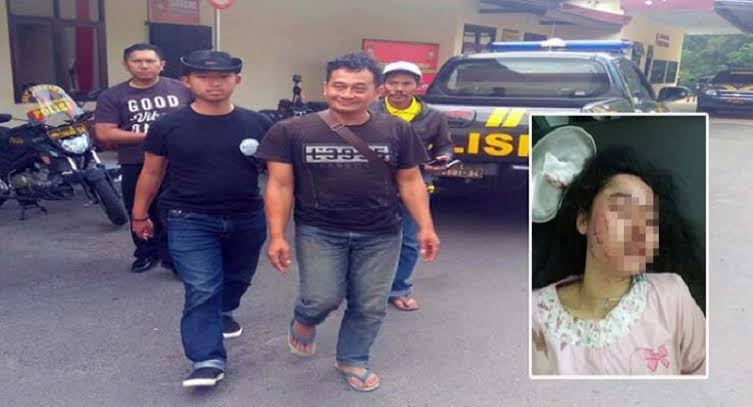 Hasil gambar untuk MEMANG KEJI...Tak Hanya Sayat Wajah Istrinya yang Cantik, Gufron Juga Setrika Wajah Mertua"