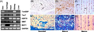 However, if you take a cell with nucleus and. Tonebp Orebp Is A Regulator Of Nucleus Pulposus Cell Function And Survival In The Intervertebral Disc Journal Of Biological Chemistry