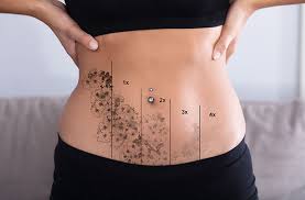 We did not find results for: Tattoo Removal Products Quick Best Guide Tram Museum