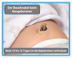 Nabelschnur Und Bauchnabel Beim Neugeborenen Pflegen