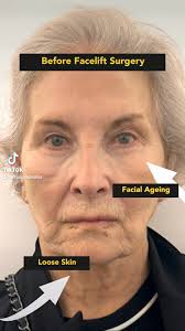 Centre For Facial Cosmetic & Plastic Surgery