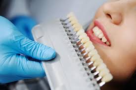 Make notes about the appearance of your gaps and why you would like when you close the gap between teeth, it places gaps between other teeth. Top 5 Ways To Take Care Of Your New Ceramic Crown Smile Modern Age Dentistry Dentists