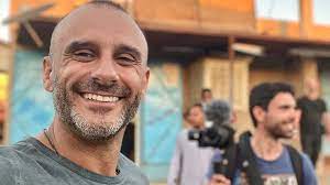 O ideal é pintar o cabelo depois de fazer a progressiva, porque quando você faz o processo de progressiva você perde todo o pigmento do fio se você fez a progressiva em um dia e seu cabelo ficou muito fragilizado, isso acontece muito depois das químicas, espere uns 15 dias, enquanto isso. Rui Unas Fez Um Implante Capilar