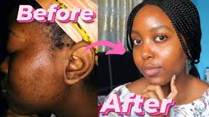 Use it at night (after cleansing and before serum). The Ordinary Alpha Arbutin 2 Ha Review Does It Really Work On Dark Skin Tone Izablogs