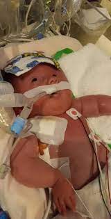 Premature baby graduates from NICU