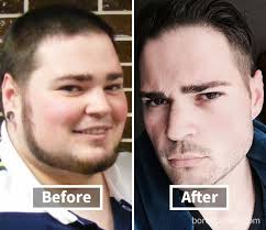 See full list on wikihow.com 128 Amazing Before After Pics Reveal How Weight Loss Changes Your Face Bored Panda