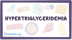 Image result for Hypertriglyceridemia
