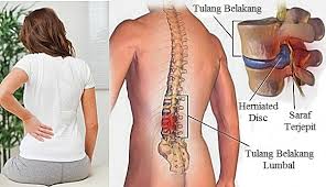 We did not find results for: Ciri Ciri Tbc Tulang Yang Kerap Dikira Gejala Penyakit Biasa