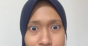 Pengalaman cabut gigi geraham bawah | tips sebelum cabut gigi. Cabut Gigi Sampai Kena Warded Athirahassin