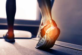 Biomechanical Assessment Podiatry - Podiatrist Sydney, West Ryde Podiatry