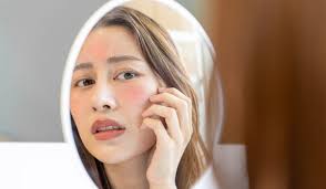 What to do when skin is itchy and red?