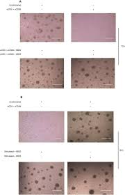 We did not find results for: Reciprocal Role Of Hbd2 And Hbd3 On The Adaptive Immune Response By Measuring T Lymphocyte Proliferation In Terms Of Cd4 And Ccr6 Expression
