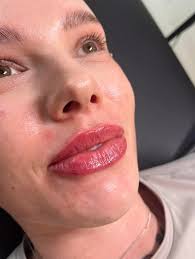 Bury Aesthetics Academy