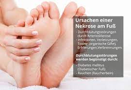 Nekrose Am Fuss Ursachen Symptome Behandlung Prognose