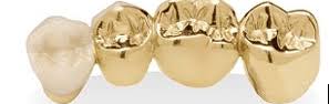 Check spelling or type a new query. Questions To Consider About Your Dental Gold Chicago Gold Gallery