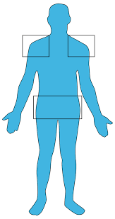 Image result for Polymyalgia Rheumatica