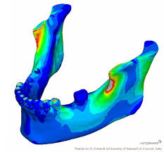 Dental Finite Element Analysis Of A 3d Lower Jaw Model Ansys Finite Element Analysis Finite Element Method