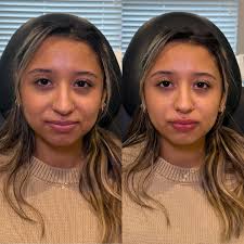 Rejuvenate Skincare and Laser