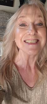 Hair regrowth after traumatic accident and multiple surgeries for women  over 60