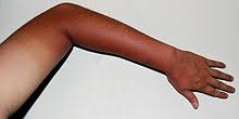 Image result for sun tan