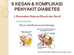 Kencing manis anda di tahap berapa? 9 Kesan Dan Komplikasi Penyakit Diabetes Vitamin Wawa Pengedar Shaklee Aktif