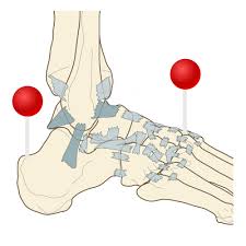 Many important blood vessels travel through the abdomen, including the aorta, inferior vena cava, and dozens of their smaller branches. Anatomy Of Lower Extremity