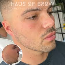 Advanced Aesthetics Clinic Coleshill