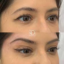 Bianca Fallon|Rongoa Maori Healer