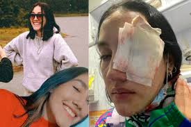 Leidy Cadena, un caso de ataque a los ojos durante Paro Nacional en Bogotá