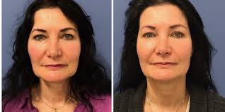 Renew Aesthetic Clinic