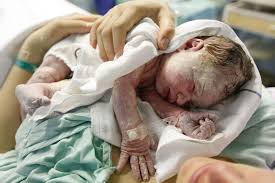 Kaseschmiere Das Neugeborene Medizinisches Baby Swissmom Ch