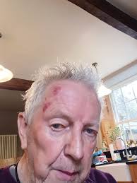 Willow has been practising head butts!