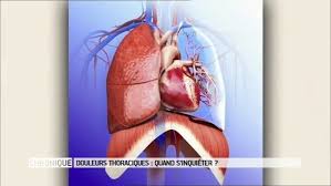 Je commence me sentir oppress par toute cette gentillesse. Douleurs Thoraciques Quand Faut Il S Inquieter