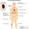 Check the full list of possible causes and conditions now! 1