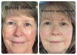 Yet another sunscreen review 🤣🤣 Heliocare 360 sensation oil free spf 50  First off, avobenzone free (a reminder that avobenzone is not your enemy,  it's a well studied and generally well tolerated