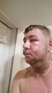 Don't ignore aches and pains in heavy diesel repair