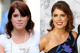 Princess eugenie and zara tindall are both expecting babies this year, with eugenie's firstborn due princess eugenie and jack brooksbank are yet to welcome their first child, which is due in february. Princesa Eugenie Casa Hoje Sabia Que A Neta De Isabel Ii Sofre De Uma Doenca Grave E Ja Teve De Ser Operada Durante 8 Horas Mundo Flash