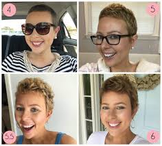 Extracts of hibiscus leaves and flowers have been found to promote the growth of hair in rats (6). 4 Month Hair Growth From Buzz Cut Novocom Top
