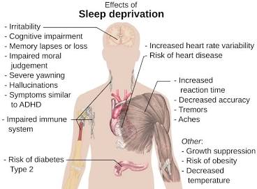 Systemic impacts of sleep deprivation, AI generated