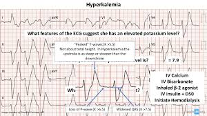 Image result for Hyperkalemia
