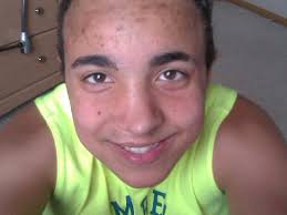 Gay and bisexual men can't donate tissue, like corneas : Shots